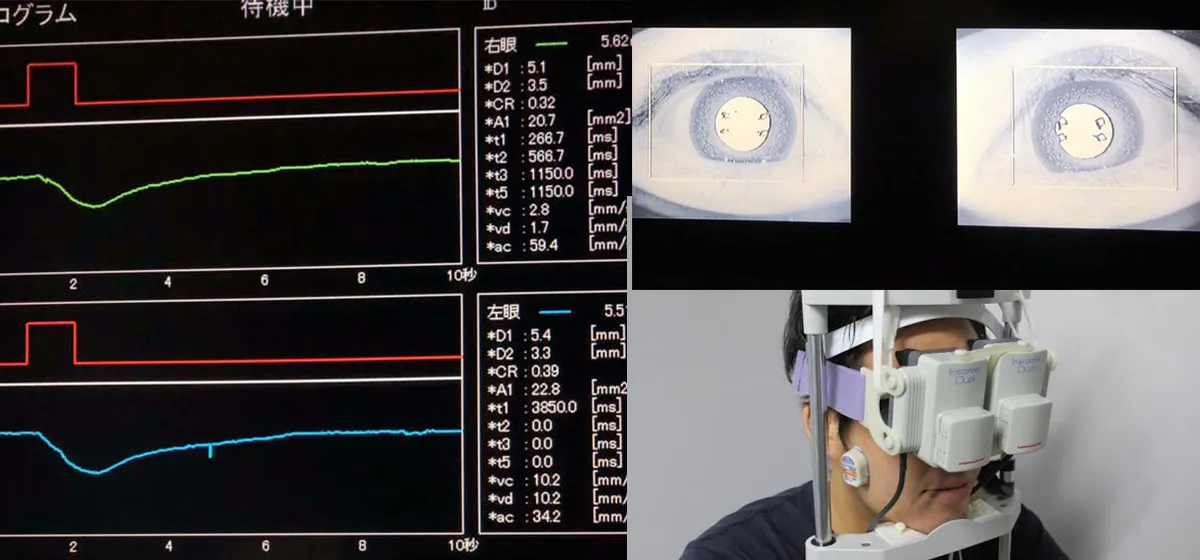 Mechanicalforce かみ合わせと自律神経の関係