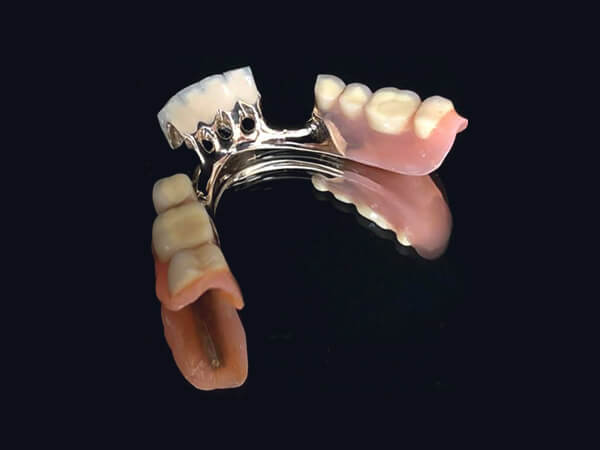Denture 2000年に作製させて頂いた入れ歯